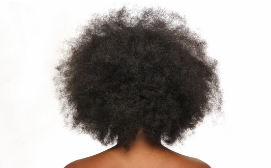 Cuir chevelu sec chez une femme aux cheveux crépus : causes et solutions